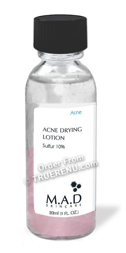 PHOTO TO COME: M.A.D SKINCARE ACNE: Acne Drying Lotion - 30ml